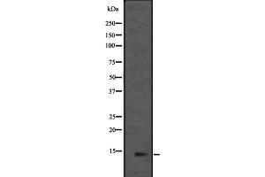 Western blot analysis of L36mt expression in HEK293 cells ,The lane on the left is treated with the antigen-specific peptide. (MRPL36 anticorps  (Internal Region))