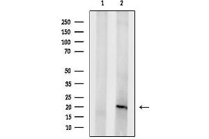 anti-CD3d Molecule, delta (CD3-TCR Complex) (CD3D) (Internal Region) antibody