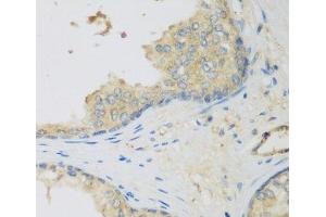 Immunohistochemistry of paraffin-embedded Human prostate using LLGL2 Polyclonal Antibody at dilution of 1:200 (40x lens). (LLGL2 anticorps)