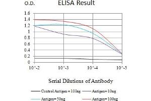 Black line: Control Antigen (100 ng),Purple line: Antigen (10 ng), Blue line: Antigen (50 ng), Red line:Antigen (100 ng) (FSHR anticorps  (AA 18-366))