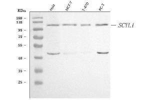 Western blot analysis of SCYL1 using anti-SCYL1 antibody (ABIN7601875).