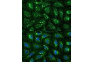anti-Chemokine (C-C Motif) Ligand 17 (CCL17) (AA 420-500) antibody