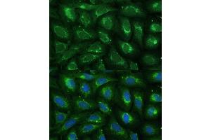 Immunofluorescence analysis of U-2 OS cells using  Polyclonal Antibody (ABIN7266299) at dilution of 1:100 (40x lens). (CCL17 anticorps  (AA 420-500))