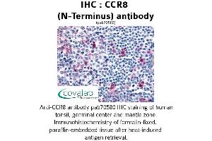 Image no. 1 for anti-Chemokine (C-C Motif) Receptor 8 (CCR8) (Extracellular Domain), (N-Term) antibody (ABIN1732786) (CCR8 anticorps  (Extracellular Domain, N-Term))