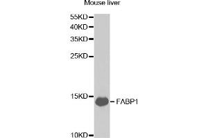 Western blot analysis of extracts of mouse liver, using FABP1 antibody (ABIN5973056) at 1/1000 dilution. (FABP1 anticorps)