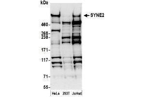 anti-Spectrin Repeat Containing, Nuclear Envelope 2 (SYNE2) (AA 4200-4250) antibody