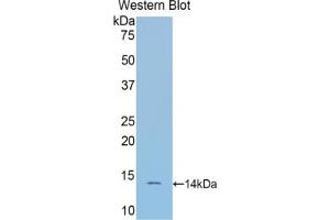 Western blot analysis of the recombinant protein. (SFRP4 anticorps  (AA 167-260))