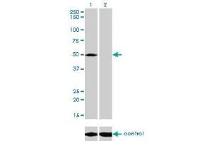 Western blot analysis of ACP2 over-expressed 293 cell line, cotransfected with ACP2 Validated Chimera RNAi (Lane 2) or non-transfected control (Lane 1). (ACP2 anticorps  (AA 1-423))