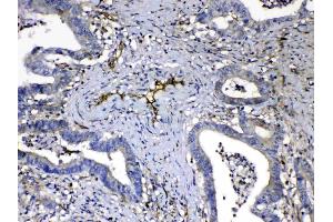 IHC analysis of HOMER3 using anti-HOMER3 antibody .