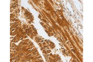 Immunohistochemistry (IHC) image for anti-Complement Factor H-Related 1 (CFHR1) antibody (ABIN1871806) (CFHR1 anticorps)