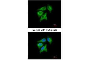 ICC/IF Image Immunofluorescence analysis of paraformaldehyde-fixed A549, using p40 , antibody at 1:200 dilution. (RABEPK anticorps)