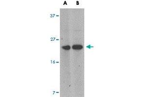 Western blot analysis of MARVELD1 in mouse heart tissue lysate with MARVELD1 polyclonal antibody  at (A) 1 and (B) 2 ug/mL . (MARVELD1 anticorps  (N-Term))