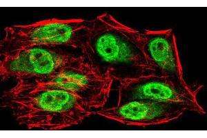 Immunofluorescence analysis of HeLa cells using SIRT6 mouse mAb (green). (SIRT6 anticorps  (AA 141-250))