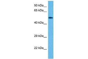 Host:  Mouse  Target Name:  VIM  Sample Tissue:  Mouse Small Intestine  Antibody Dilution:  1ug/ml
