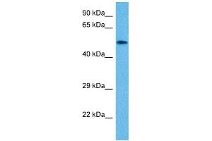Host:  Mouse  Target Name:  VIM  Sample Tissue:  Mouse Small Intestine  Antibody Dilution:  1ug/ml (Vimentin anticorps  (N-Term))