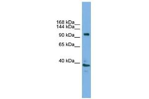 WB Suggested Anti-Atp6v0a1 Antibody Titration:  0.