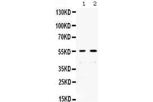 Western blot analysis of XRCC4 expression in SW620 whole cell lysates (lane 1) and A431 whole cell lysates (lane 1). (XRCC4 anticorps  (N-Term))
