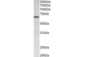 Western Blotting (WB) image for anti-SRY (Sex Determining Region Y)-Box 11 (SOX11) (Internal Region) antibody (ABIN2464999) (SOX11 anticorps  (Internal Region))