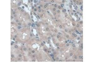 Detection of a1AGP in Rat Kidney Tissue using Monoclonal Antibody to Alpha-1-Acid Glycoprotein (a1AGP) (ORM1 anticorps  (AA 20-186))