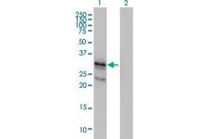 Lane 1: C1QTNF2 transfected lysate ( 30 KDa).