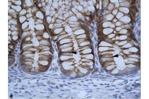 anti-Suppressor of Variegation 3-9 Homolog 1 (Drosophila) (SUV39H1) (C-Term) antibody
