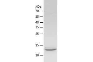 Western Blotting (WB) image for ATPase, H+ Transporting, Lysosomal 14kDa, V1 Subunit F (ATP6V1F) (AA 1-119) protein (His tag) (ABIN7121941)