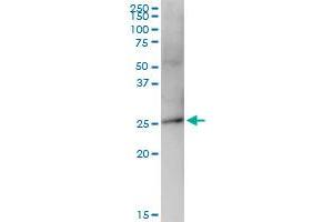 anti-Immunoglobulin Superfamily, Member 6 (IGSF6) (AA 1-241) antibody