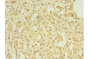 Immunohistochemistry of paraffin-embedded human adrenal gland tissue using ABIN7173349 at dilution of 1:100 (TREML2 anticorps  (AA 19-268))
