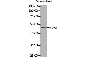 Western Blotting (WB) image for anti-3-phosphoinositide Dependent Protein Kinase-1 (PDPK1) (AA 1-150) antibody (ABIN5663787) (PDPK1 anticorps  (AA 1-150))