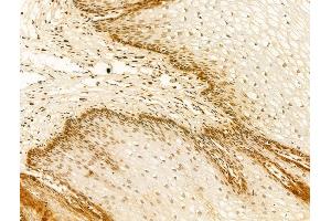ABIN7094280 and ABIN7098327 at 1/100 staining Human normal tissues adjacent to esophageal cancer by IHC-P. (HNRNPR anticorps  (C-Term))