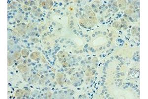 Immunohistochemistry of paraffin-embedded human pancreatic tissue using ABIN7169136 at dilution of 1:100 (PAK6 anticorps  (AA 1-270))
