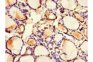 Immunohistochemistry of paraffin-embedded human thyroid tissue using ABIN7159100 at dilution of 1:100 (MED1 anticorps  (AA 878-1031))