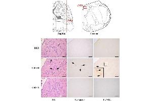Neuronal apoptosis in acNTS of CRS mice.
