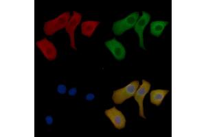 CTNNAL1 Mouse Monoclonal Antibody staining Hela cells by IF/ICC.
