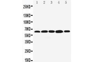 Anti-Bag3 antibody, Western blotting Lane 1: MCF-7 Cell Lysate Lane 2: JURKAT Cell Lysate Lane 3: A549 Cell Lysate Lane 4: HELA Cell Lysate Lane 5: COLO320 Cell Lysate
