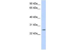WB Suggested Anti-NKAIN4 Antibody Titration: 0. (NKAIN4 anticorps  (Middle Region))