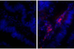 Paraffin embedded human gastric cancer tissue was stained with Rabbit IgG-UNLB isotype control and DAPI. (Lapin anti-Humain IgG Anticorps (Alkaline Phosphatase (AP)))