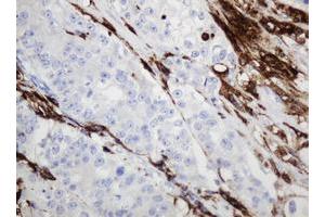 Image no. 4 for anti-Sex Determining Region Y (SRY) antibody (ABIN1501140) (SRY anticorps)