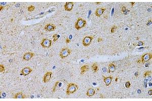 Immunohistochemistry of paraffin-embedded Rat brain using OLR1 Polyclonal Antibody at dilution of 1:200 (40x lens). (OLR1 anticorps)