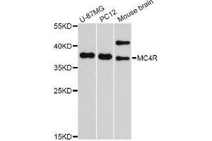 Western blot analysis of extracts of various cell lines, using MC4R Antibody. (MC4R anticorps  (AA 1-100))