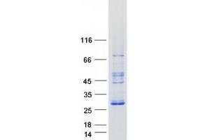 Validation with Western Blot