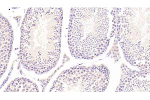 Detection of IL25 in Mouse Testis Tissue using Polyclonal Antibody to Interleukin 25 (IL25)