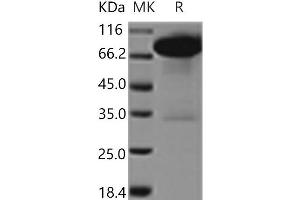 Western Blotting (WB) image for Discoidin Domain Receptor tyrosine Kinase 1 (DDR1) protein (Fc Tag) (ABIN7321079) (DDR1 Protein (Fc Tag))
