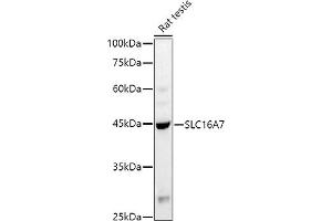 Western blot analysis of extracts of Rat testis, using (ABIN6134859, ABIN6147861, ABIN6147862 and ABIN6215999) at 1:1000 dilution. (SLC16A7 anticorps  (C-Term))