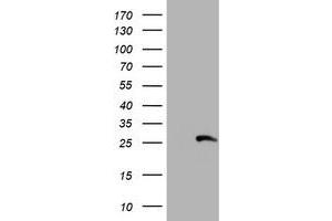 Western Blotting (WB) image for anti-Regulatory Factor X-Associated Ankyrin Containing Protein (RFXANK) antibody (ABIN1500683) (RFXANK anticorps)