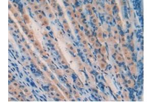 IHC-P analysis of Mouse Stomach Tissue, with DAB staining. (SOD2 anticorps  (AA 25-222))