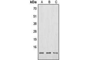 Western blot analysis of Neuromedin B expression in HEK293T (A), Raw264. (Neuromedin B anticorps  (N-Term))