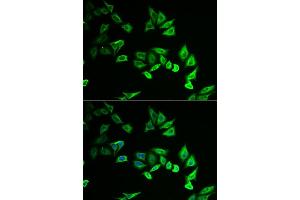 Immunofluorescence analysis of U2OS cells using MYOZ2 antibody (ABIN6129772, ABIN6144299, ABIN6144300 and ABIN6222126). (MYOZ2 anticorps  (AA 1-264))