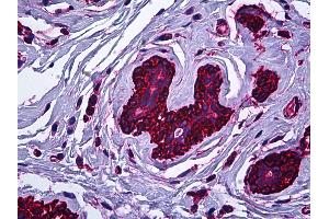 Anti-MYH9 antibody IHC of human breast. (Myosin 9 anticorps)