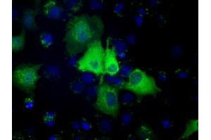Anti-PSMC3 mouse monoclonal antibody (ABIN2453538) immunofluorescent staining of COS7 cells transiently transfected by pCMV6-ENTRY PSMC3 (RC201790).